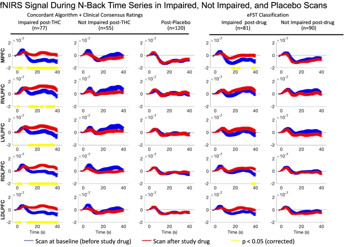 Chart showing HbO response at pre- and post-dose by consensus rating, placebo and eFSR rating