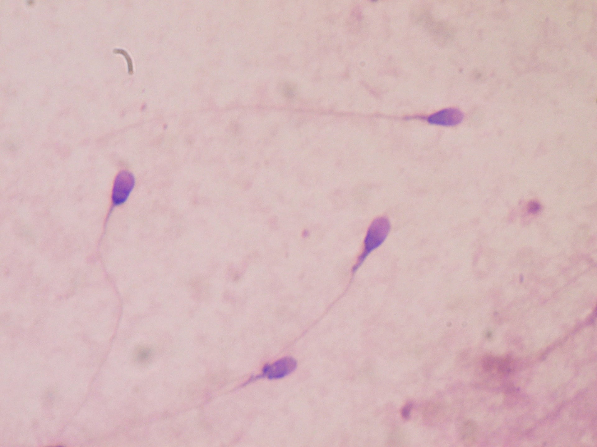 Weill Cornell Medical College researchers looking into birth control that inhibits sperm movement