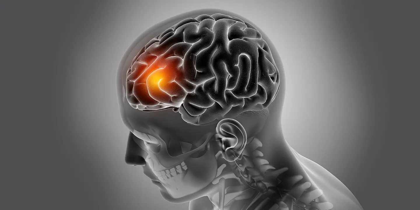 AI tool makes brain tumour classification faster and more accurate