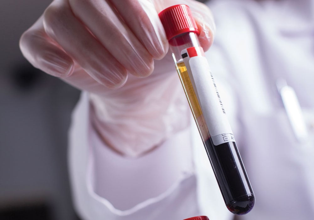 New Brunswick to use blood testing method for identifying lung cancer