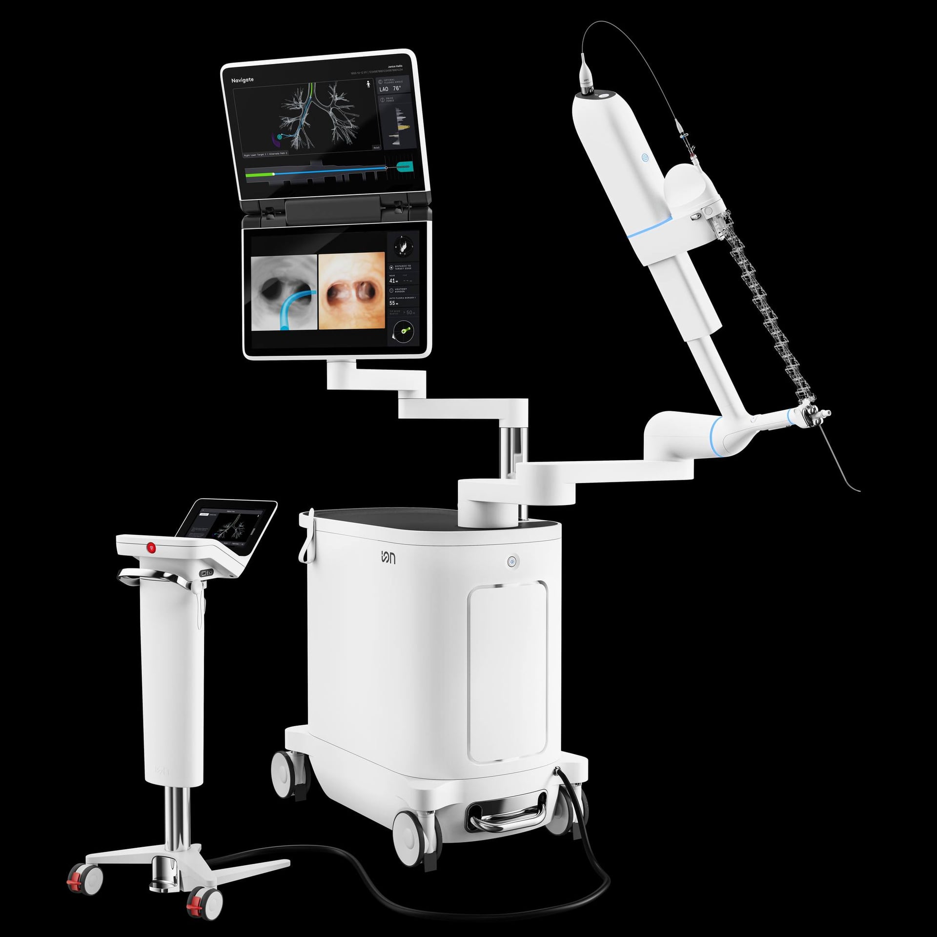 UK hospital starts using advanced robotic tool for early-stage lung cancer detection