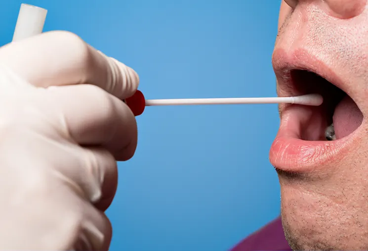 UK researchers conduct successful trials with saliva 'dip' lung cancer test