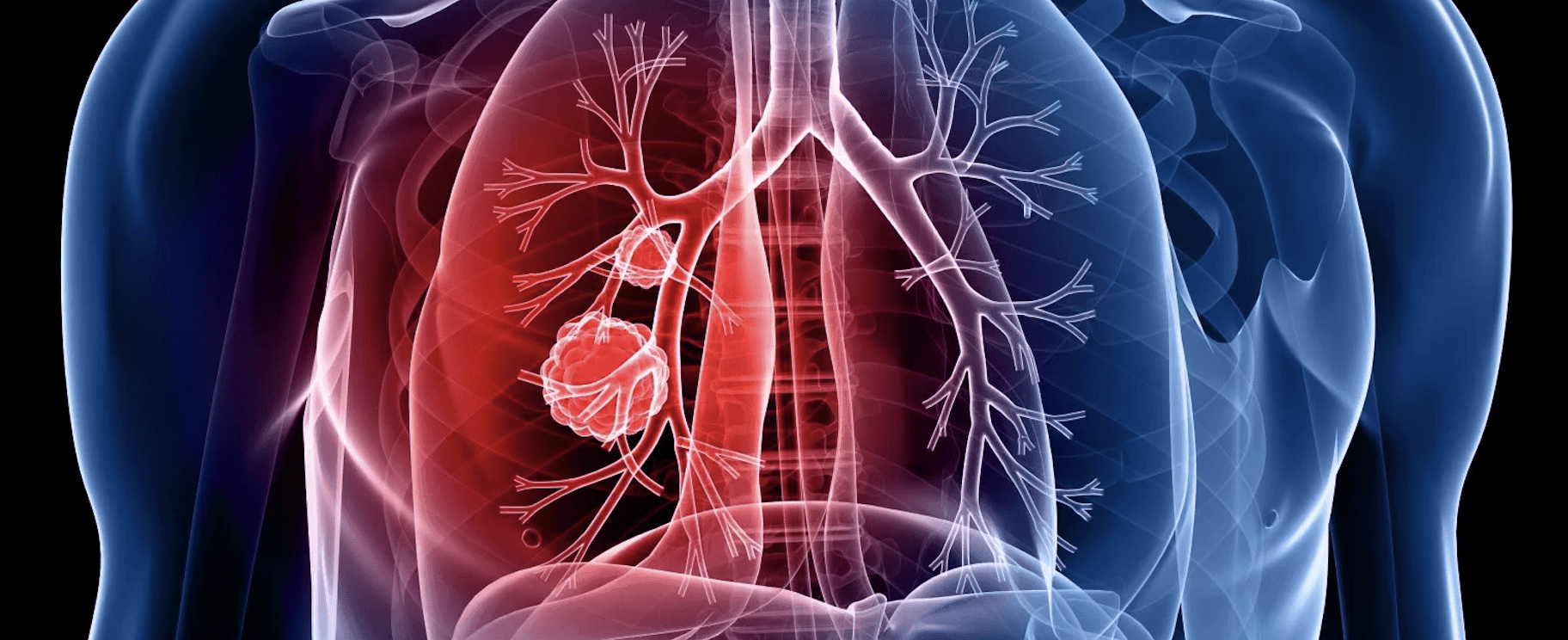 International Lung Cancer Consortium holds 20th annual meeting in Nashville
