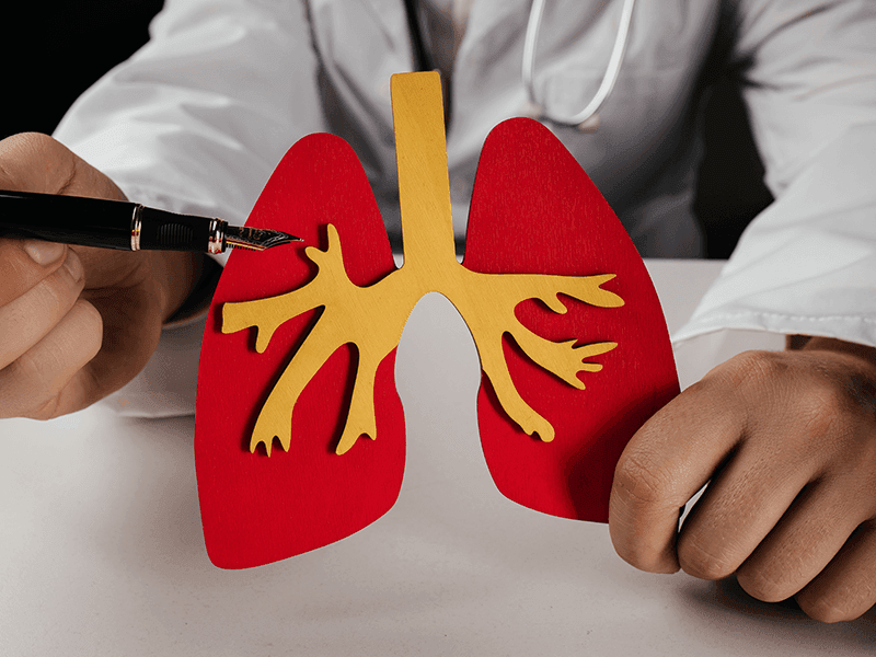Mississippi research centre gets US$1.8M grant for its lung cancer screening program