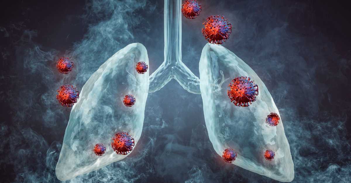 Chinese researchers develop breath analysis tech for lung cancer detection