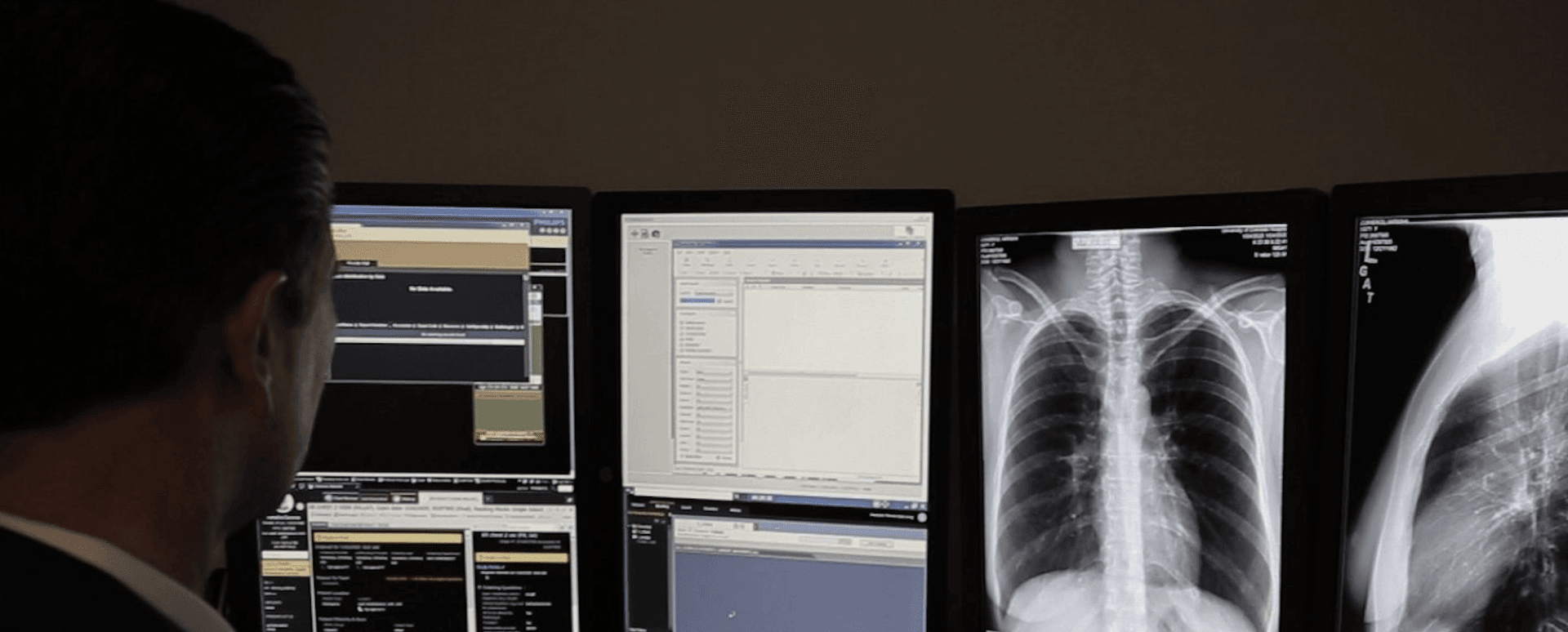 AI lung cancer screening tech developer, Imidex, seeks buyer at Chicago conference