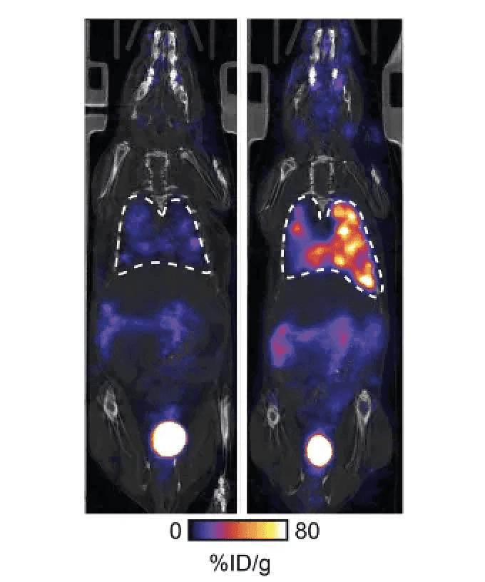 Scientists use new scan technique to light up lung cancer cells 'like a Christmas tree'