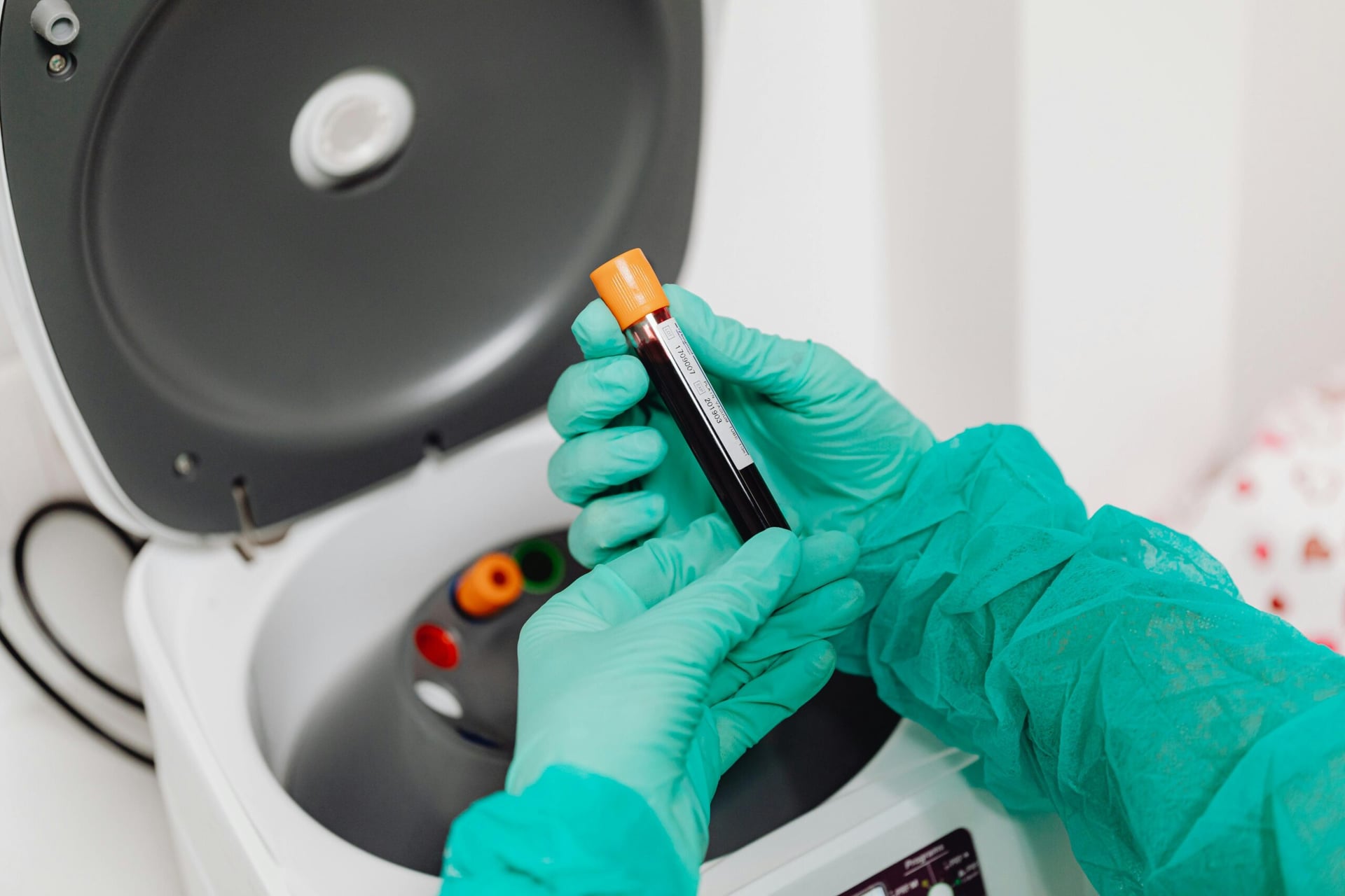 Scottish university study finds biomarker blood testing can reduce fatalities by 40%