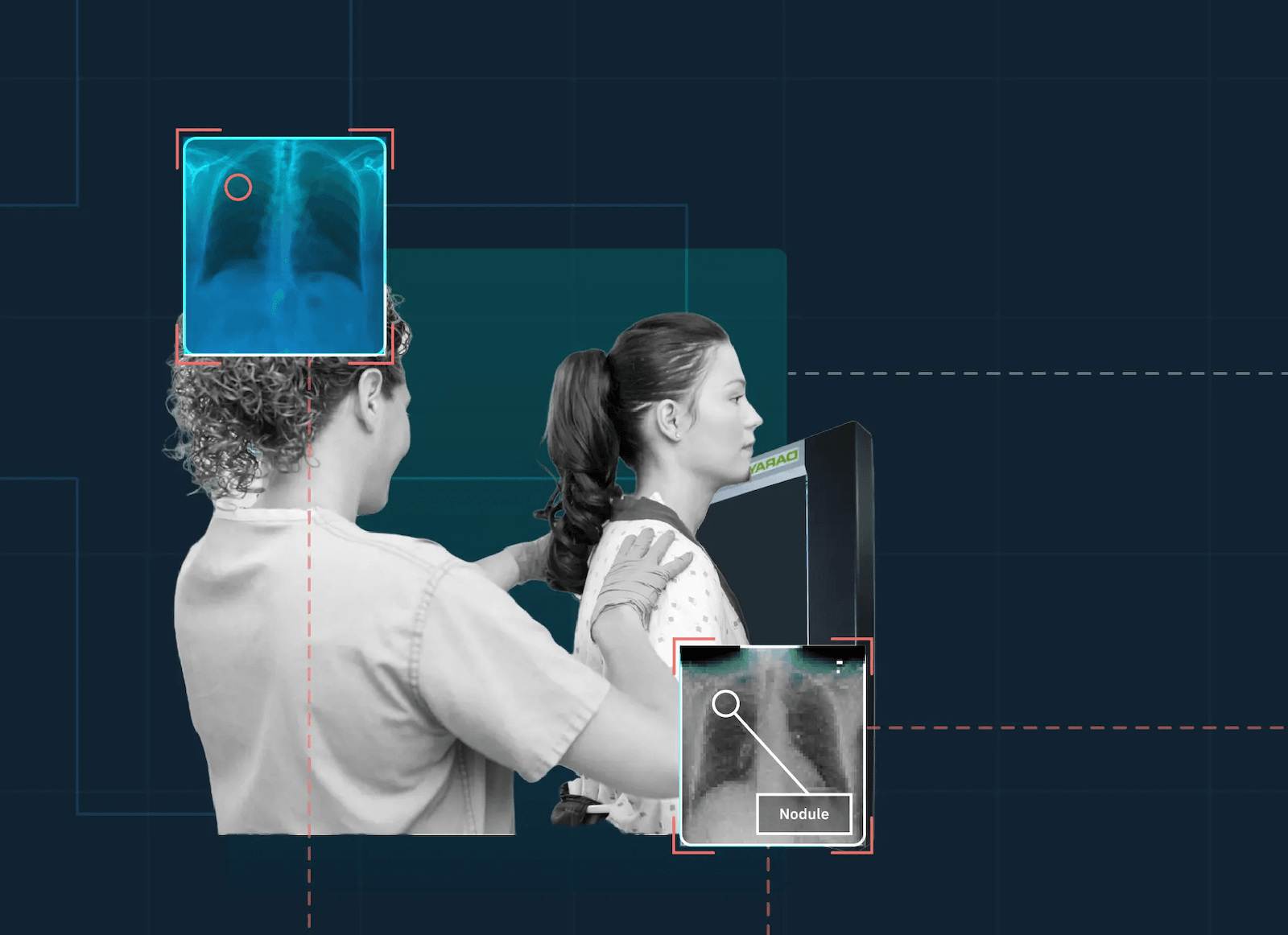 Ohio hospital compares AI X-ray scans to radiologist assessments in clinical trial