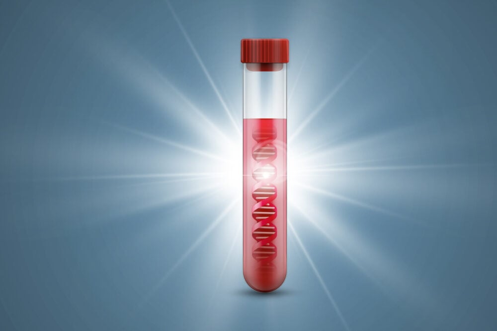 Australian biotech uncovers broader view of tumour genetics with liquid biopsy