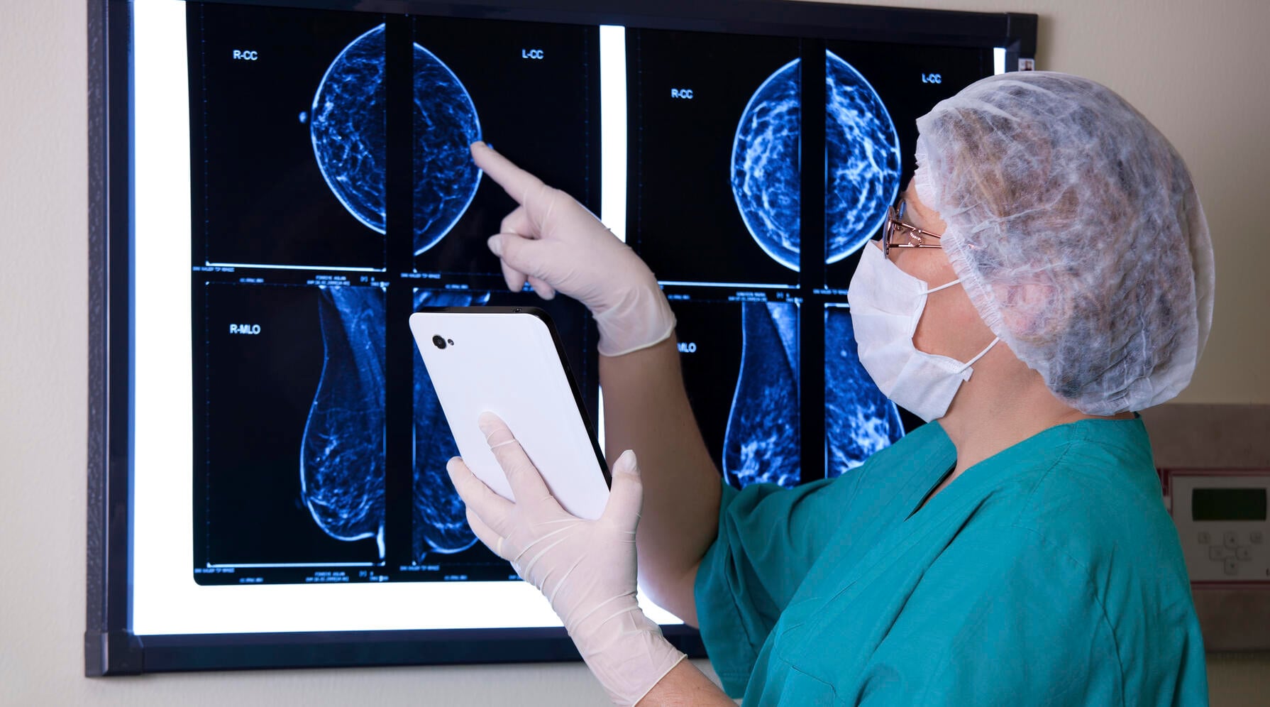 Combining mammograms with lung cancer screening could boost female uptake