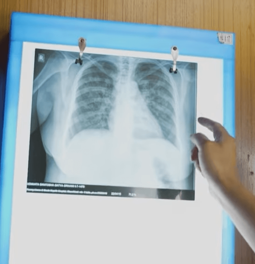 Qure.ai offers artificial intelligence training in US to transform clinical operations