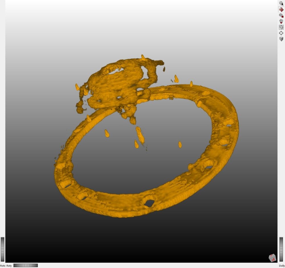 New Fraunhofer technology promises lower radiation in cancer imaging