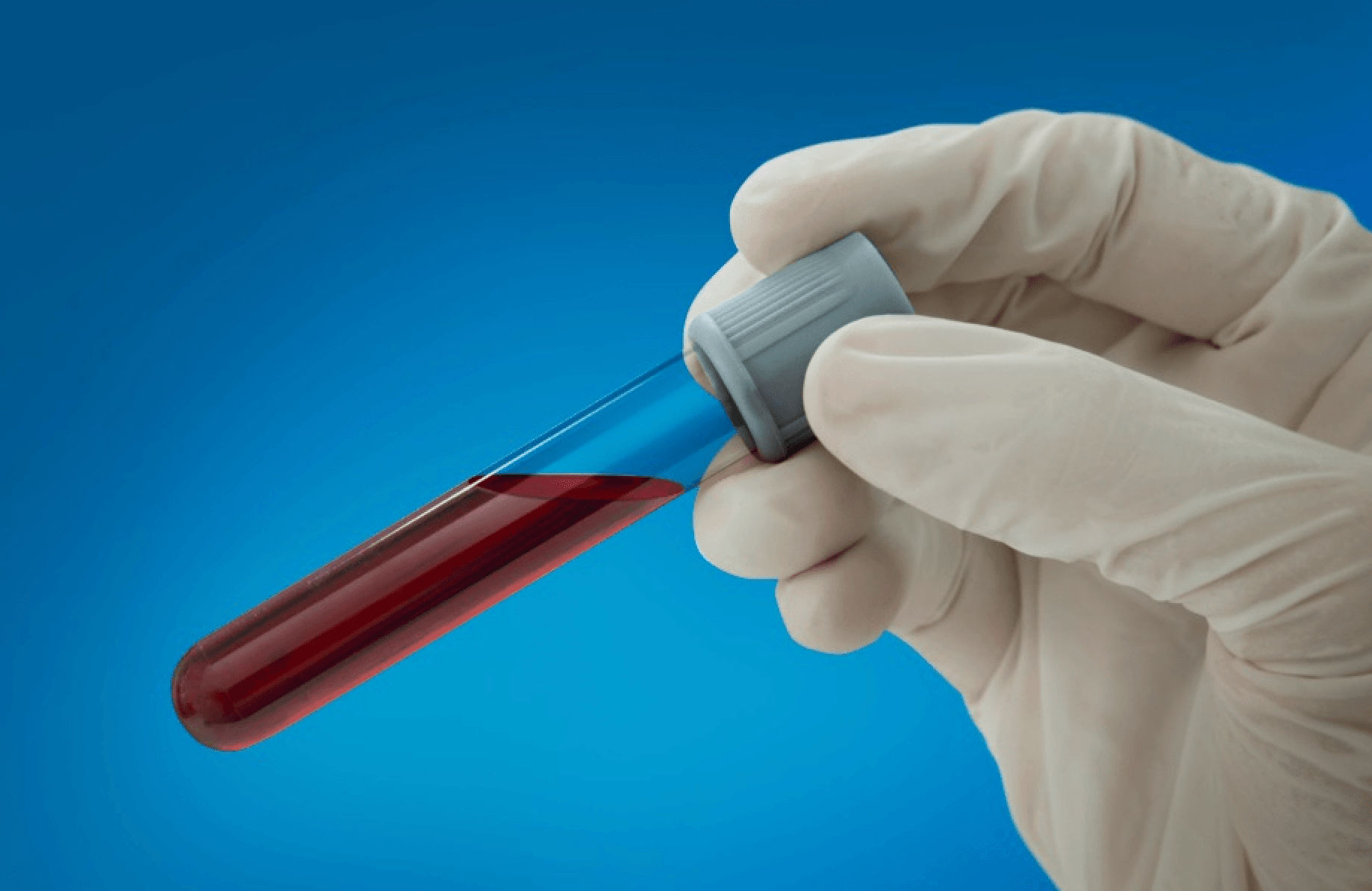 Guardant Health becomes key backer for lung cancer screening awareness campaign