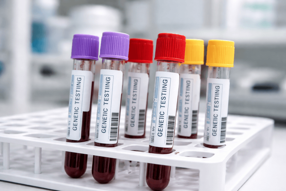 BillionToOne adds pharmacogenomics, clonal filtering to Northstar cancer test