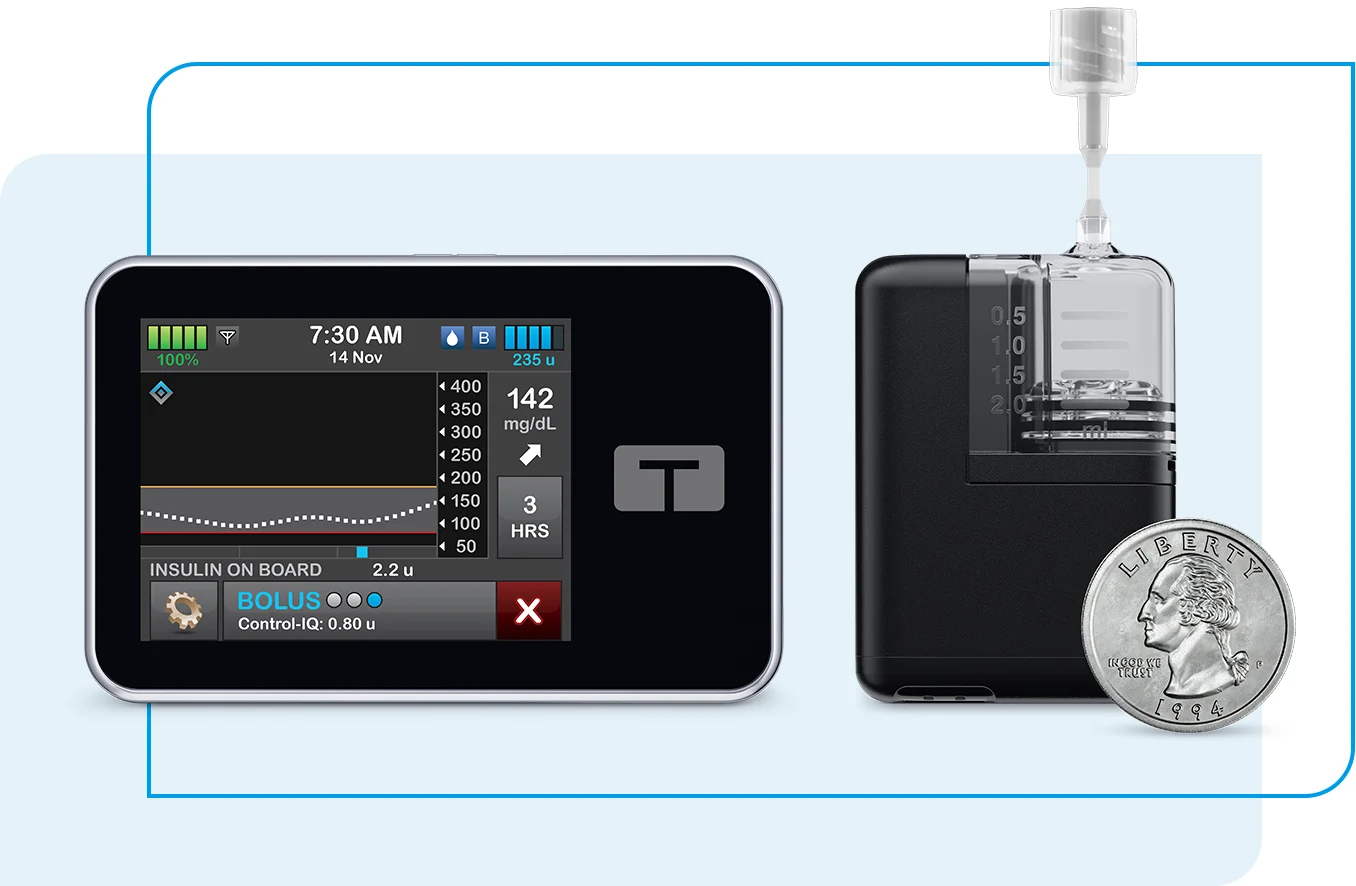 FDA issues recall for Tandem Mobi insulin pumps over concerning software glitch