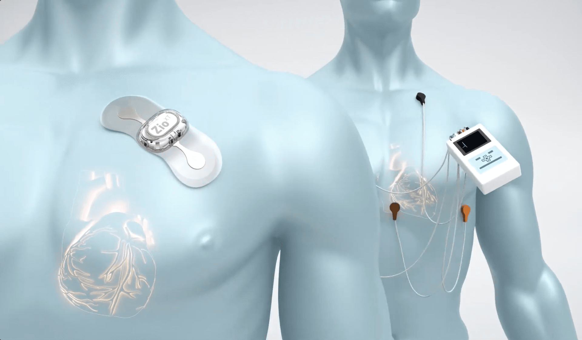 Cyberattacks on medtech companies becoming a frequent occurrence