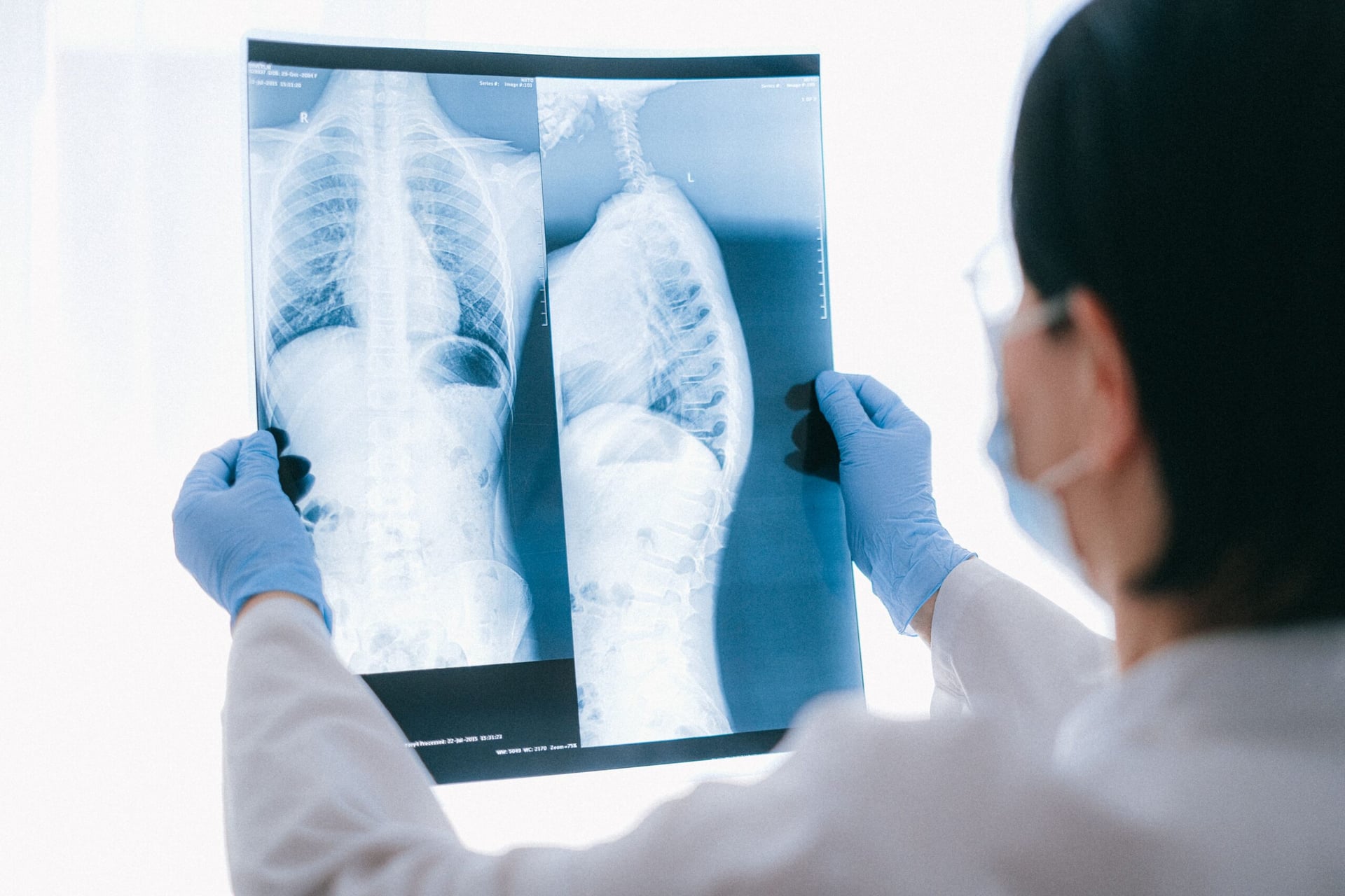 FDA awards breakthrough device designation to Aidoc's AI X-ray tech