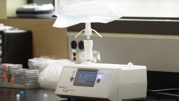 International lung cancer screening market poised for steady growth: 2025 report
