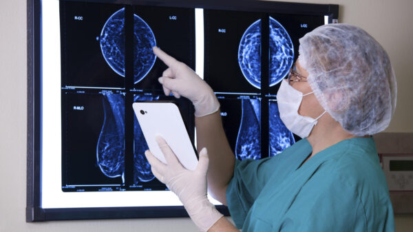 Combining mammograms with lung cancer screening could boost female uptake