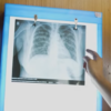 Qure.ai offers artificial intelligence training in US to transform clinical operations