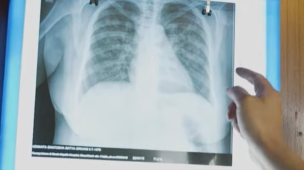 Qure.ai offers artificial intelligence training in US to transform clinical operations