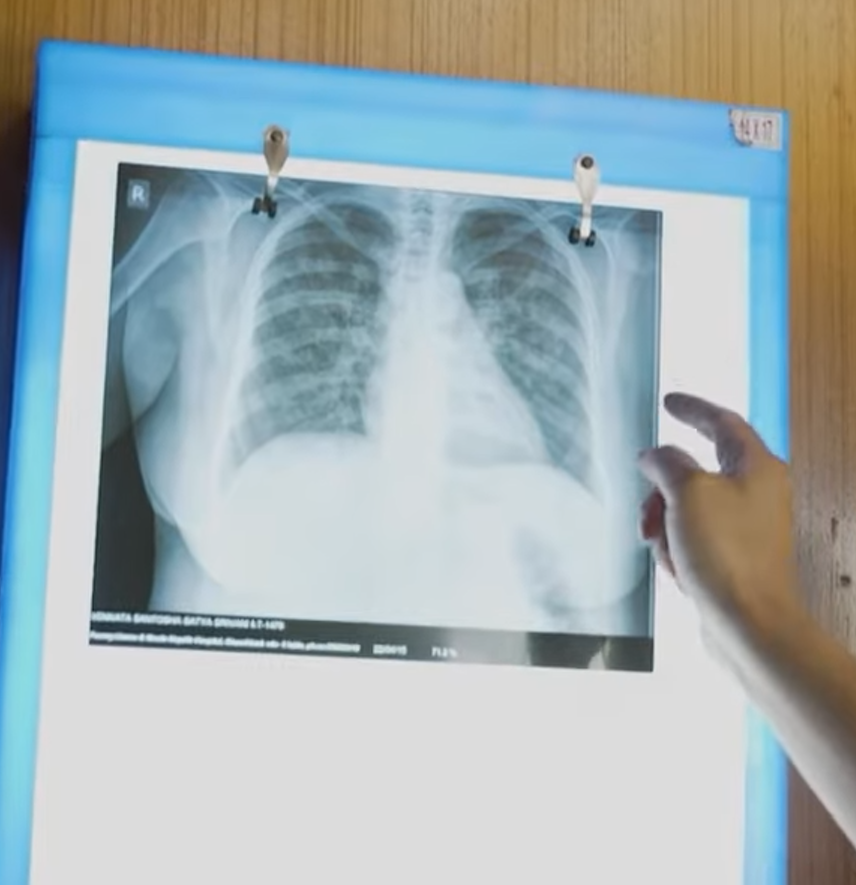 Qure.ai offers artificial intelligence training in US to transform clinical operations