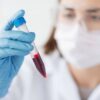 The NHS in England introduces innovative new cancer detection options