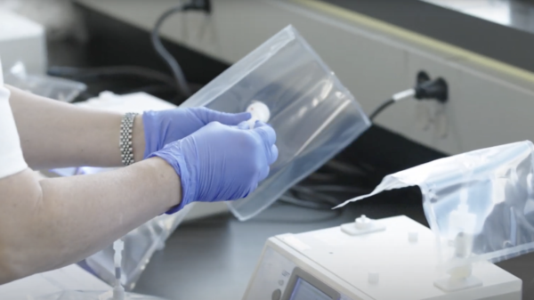 Breath Diagnostics tech achieves pneumonia prediction breakthrough in peer-reviewed study