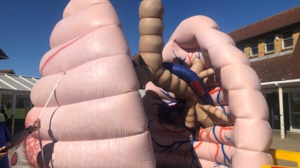 Giant inflatable lungs help promote cancer screening in United Kingdom