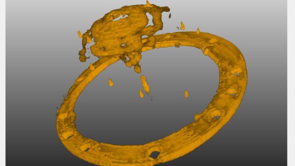 New Fraunhofer technology promises lower radiation in cancer imaging