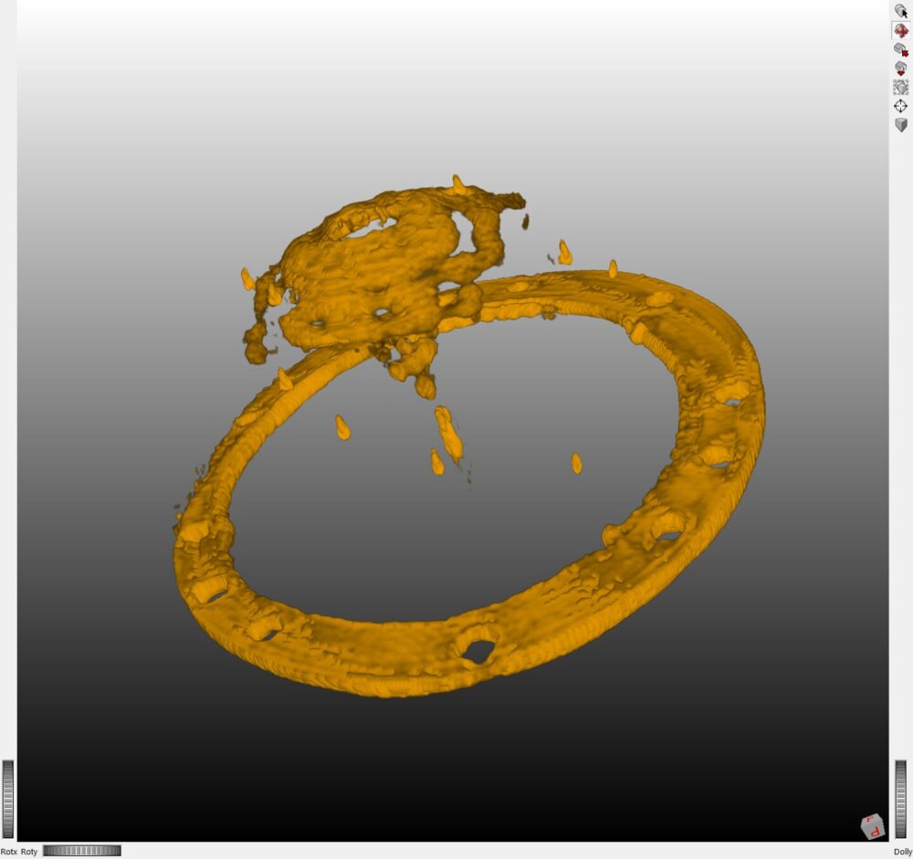 New Fraunhofer technology promises lower radiation in cancer imaging