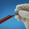 Guardant Health becomes key backer for lung cancer screening awareness campaign