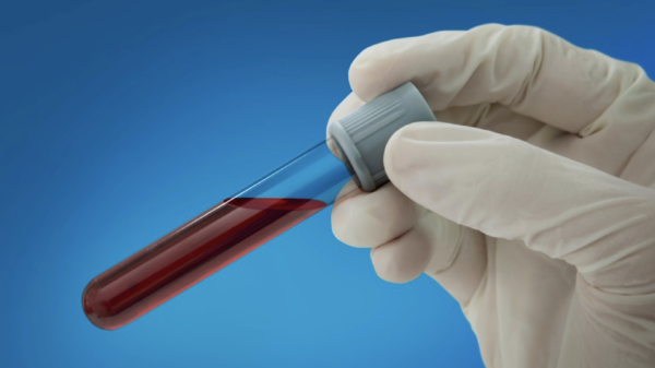 Guardant Health becomes key backer for lung cancer screening awareness campaign
