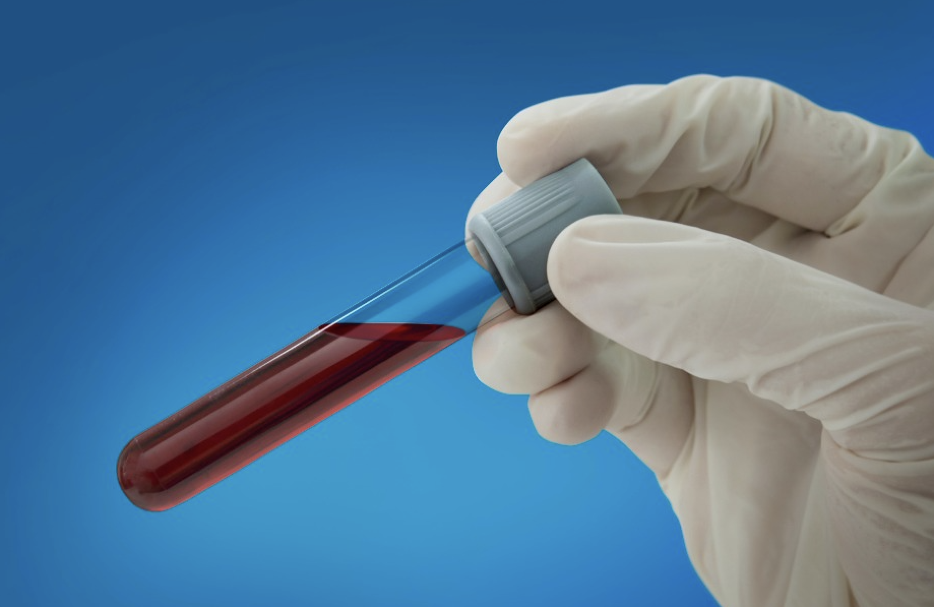 Guardant Health becomes key backer for lung cancer screening awareness campaign