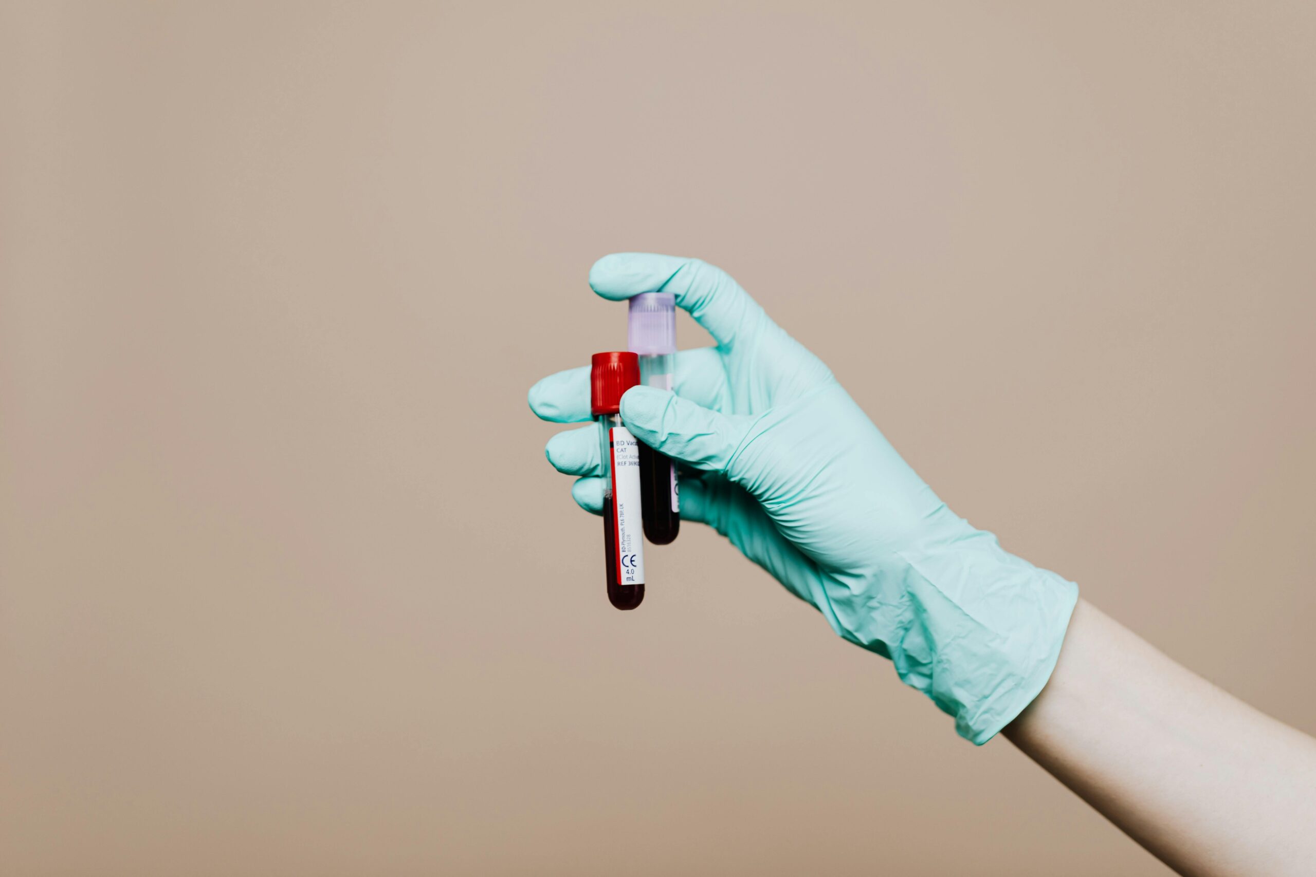 Mercy BioAnalytics raises US$59M to commercialize ovarian cancer blood test