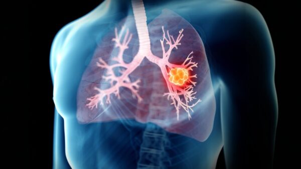 University of Bath spinout tests real-time lung biopsy device