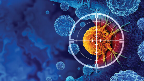Hong Kong researchers deploy AI to revolutionize lung cancer diagnosis