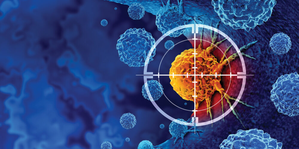 Hong Kong researchers deploy AI to revolutionize lung cancer diagnosis