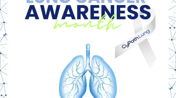 Lung cancer awareness month: a Mugglehead roundup
