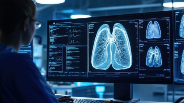 Bristol Myers Squibb teams up with Microsoft for AI-powered lung cancer detection