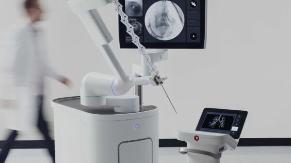 NHS lung cancer screening pilot combines power of AI software and robotic bronchoscopy