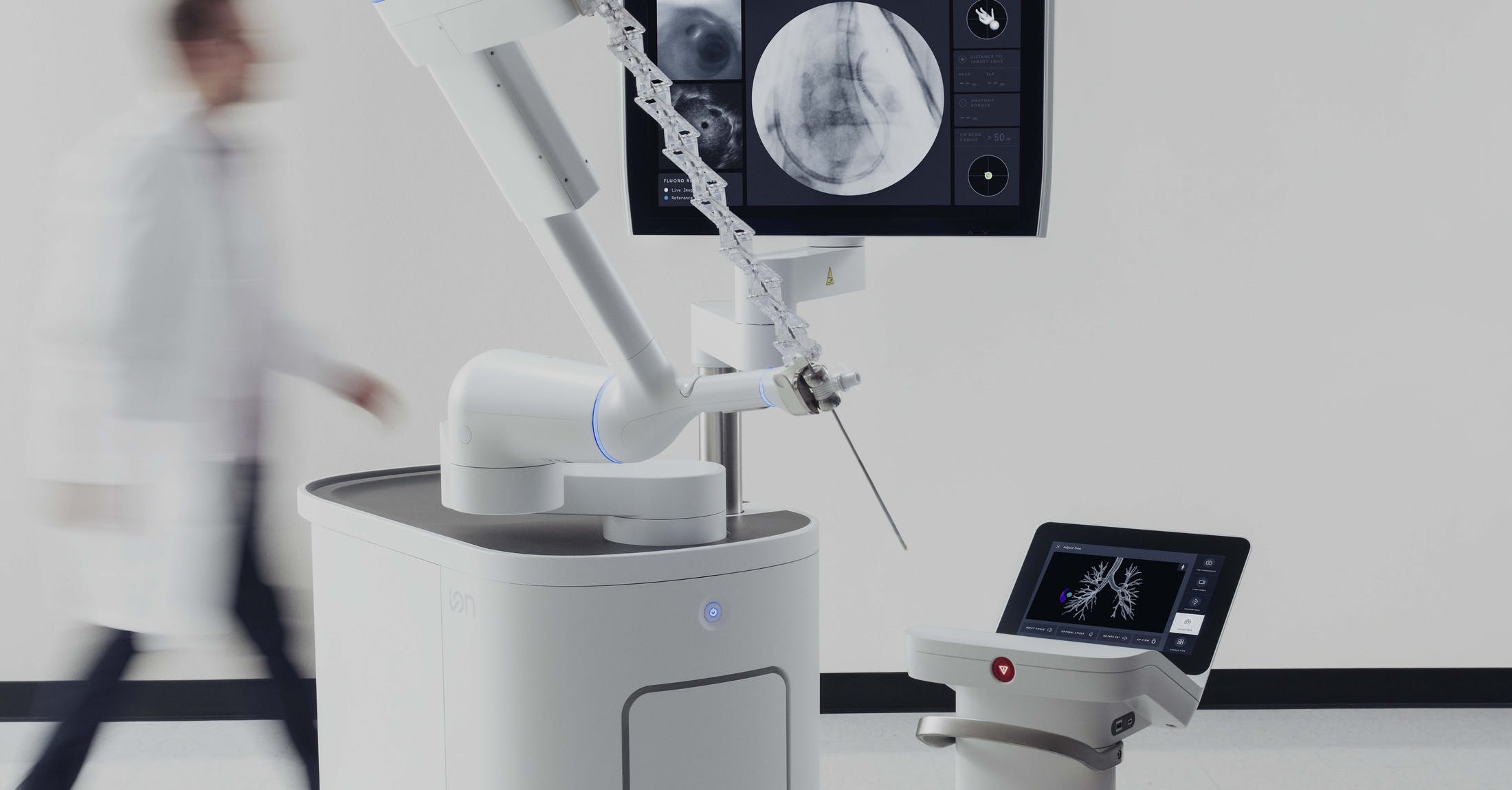 NHS lung cancer screening pilot combines power of AI software and robotic bronchoscopy