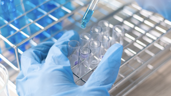 Kairos Pharma acquires lung cancer drug assets from Celyn Therapeutics