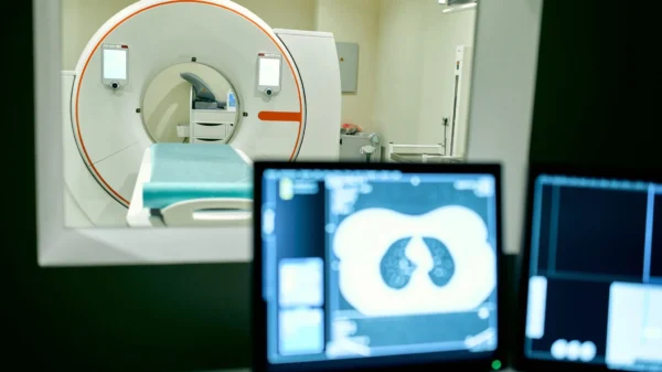 Optellum breaks new ground with TGA approval for AI-powered lung nodule solution