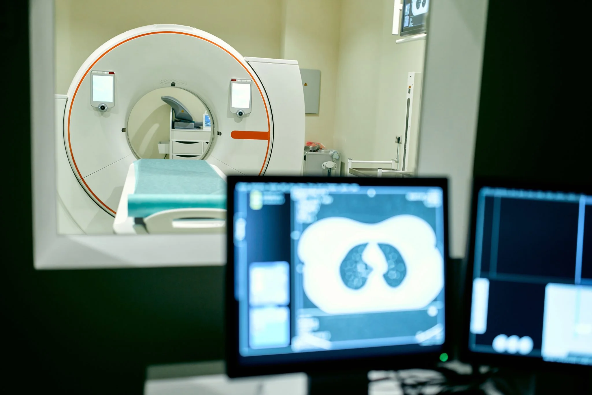 Optellum breaks new ground with TGA approval for AI-powered lung nodule solution