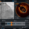Abbott's coronary imaging tech secures regulatory wins with FDA clearance, CE mark