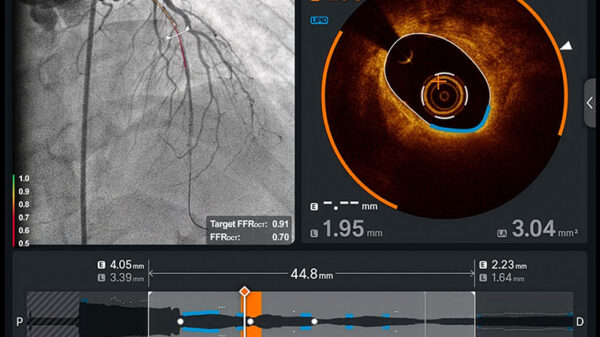 Abbott's coronary imaging tech secures regulatory wins with FDA clearance, CE mark