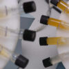 Cambridge researchers develop urine test that could detect lung cancer years earlier