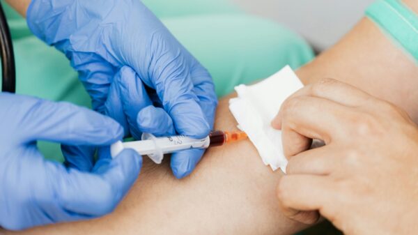 PrognomiQ shares promising early results from novel lung cancer blood test